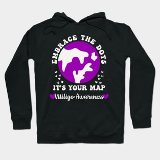 Vitiligo Awareness Embrace the Dots Vitiligo Acceptance Hoodie